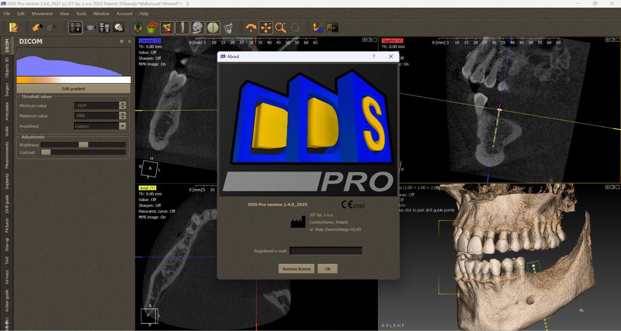 DDS Pro Full
