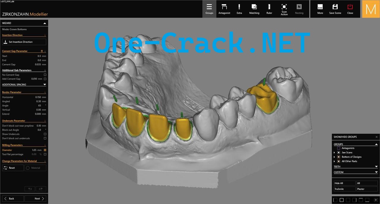 ZirkonZahn Modellier